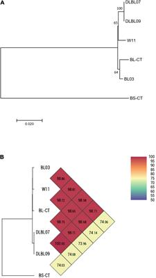 Bifidobacteria Strain Typing by Fourier Transform Infrared Spectroscopy